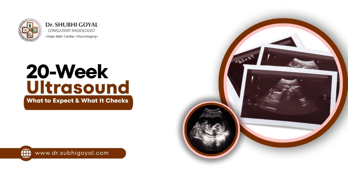 20-Week Ultrasound (Anatomy Scan): What to Expect and What It Checks