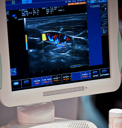 Doppler Imaging