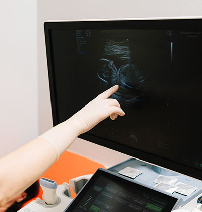 Ultrasound