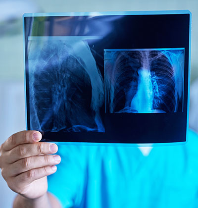 X-Ray