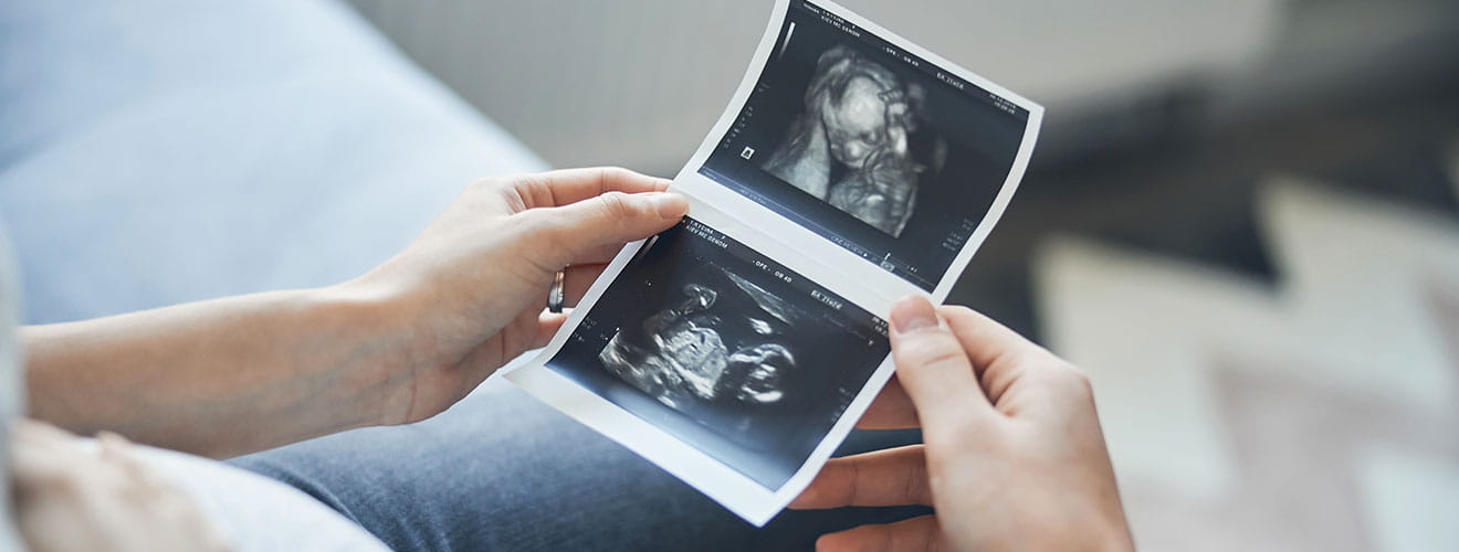 Twin Pregnancy Scan