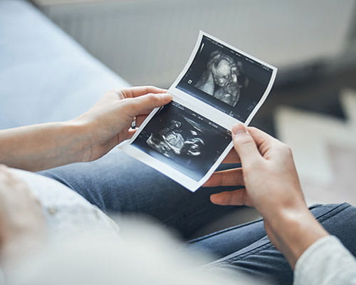 Twin Pregnancy Scan