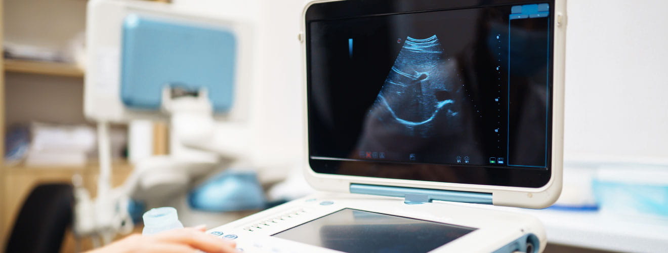 Ultrasound (USG)