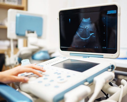 Ultrasound (USG)