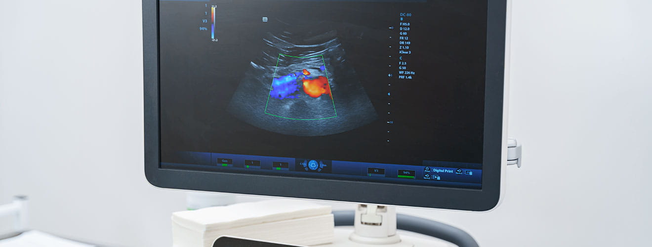 Colour Doppler