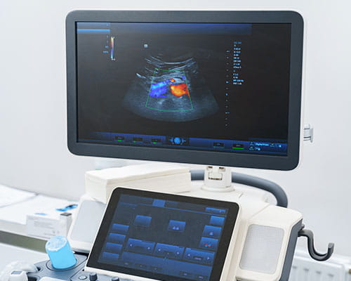 Colour Doppler